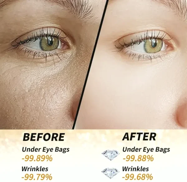 Golden Shine Under Eye Patches - 60 Pieces Treatment for Puffy Eyes