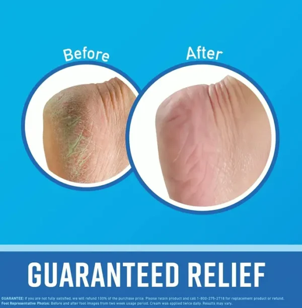 O'Keeffe's Foot Cream Set 3.0 Ounce Tubes